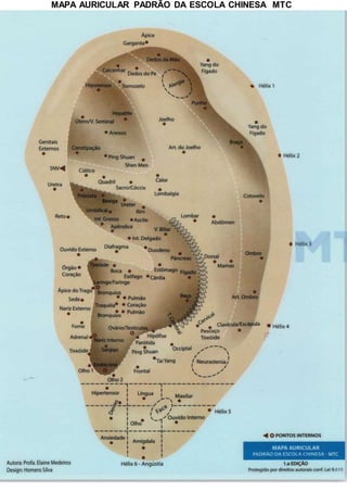 MAPA AURICULAR PADRÃO DA ESCOLA CHINESA MTC
 