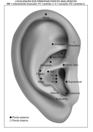 LOCALIZAÇÃO DOS PRINCIPAIS PONTOS ANALGÉSICOS
RM = relaxamento muscular; P1 = pulmão 1; C = coração; P2 = pulmão 2.
 