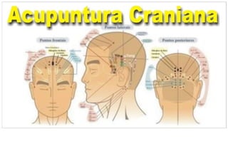 MAPA AURICULOTERAPIA DE A a Z.docx
