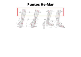 MAPA AURICULOTERAPIA DE A a Z.docx