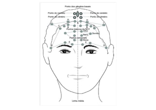 MAPA AURICULOTERAPIA DE A a Z.docx