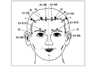 MAPA AURICULOTERAPIA DE A a Z.docx