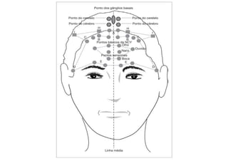 MAPA AURICULOTERAPIA DE A a Z.docx