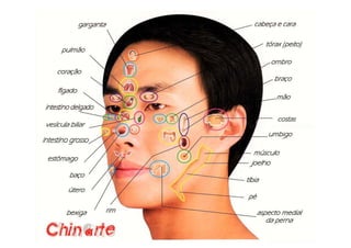 MAPA AURICULOTERAPIA DE A a Z.docx