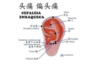 MAPA AURICULOTERAPIA DE A a Z.docx
