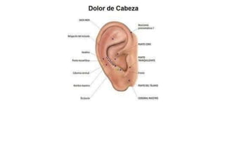 MAPA AURICULOTERAPIA DE A a Z.docx