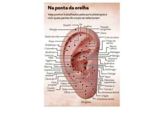 MAPA AURICULOTERAPIA DE A a Z.docx