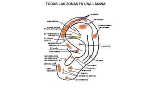 MAPA AURICULOTERAPIA DE A a Z.docx