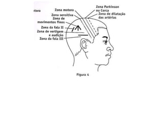 MAPA AURICULOTERAPIA DE A a Z.docx