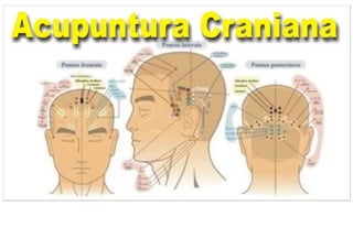 MAPA AURICULOTERAPIA DE A a Z.docx