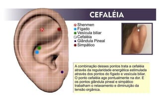 MAPA AURICULOTERAPIA DE A a Z.docx