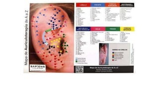 MAPA AURICULOTERAPIA DE A a Z.docx