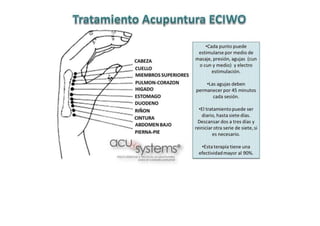 MAPA AURICULOTERAPIA DE A a Z.docx