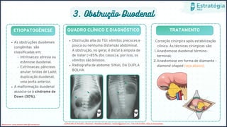 3. Obstrução Duodenal
ETIOPATOGÊNESE QUADRO CLÍNICO E DIAGNÓSTICO TRATAMENTO
Anastomose duodenal término-
terminal;
Anastomose em forma de diamante –
diamond-shaped (veja abaixo).
Correção cirúrgica após estabilização
clínica. As técnicas cirúrgicas são:
1.
2.
Obstrução alta do TGI: vômitos precoces e
pouca ou nenhuma distensão abdominal.
A obstrução, no geral, é distal à ampola de
de Vater (>85% dos casos) e, por isso, os
vômitos são biliosos.
Radiografia de abdome: SINAL DA DUPLA
BOLHA.
As obstruções duodenais
congênitas são
classificadas em:
Intrínsecas: atresia ou
estenose duodenal.
Extrínsecas: pâncreas
anular; bridas de Ladd;
duplicação duodenal;
veia porta anterior.
A malformação duodenal
associa-se à síndrome de
Down (30%).
Medicina livre, venda proibida, twitter @Livremedicina COPIA NÃO É ROUBO / Resimed - Residência Médica / resimed@proton.me / +56 9 39151558 / https://t.me/resimed
 