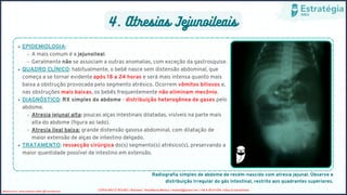 4. Atresias Jejunoileais
EPIDEMIOLOGIA:
A mais comum é a jejunoileal.
Geralmente não se associam a outras anomalias, com exceção da gastrosquise.
QUADRO CLÍNICO: habitualmente, o bebê nasce sem distensão abdominal, que
começa a se tornar evidente após 18 a 24 horas e será mais intensa quanto mais
baixa a obstrução provocada pelo segmento atrésico. Ocorrem vômitos biliosos e,
nas obstruções mais baixas, os bebês frequentemente não eliminam mecônio.
DIAGNÓSTICO: RX simples do abdome - distribuição heterogênea de gases pelo
abdome.
Atresia jejunal alta: poucas alças intestinais dilatadas, visíveis na parte mais
alta do abdome (figura ao lado).
Atresia ileal baixa: grande distensão gasosa abdominal, com dilatação de
maior extensão de alças de intestino delgado.
TRATAMENTO: ressecção cirúrgica do(s) segmento(s) atrésico(s), preservando a
maior quantidade possível de intestino em extensão.
Radiografia simples de abdome de recém-nascido com atresia jejunal. Observe a
distribuição irregular do gás intestinal, restrito aos quadrantes superiores.
Medicina livre, venda proibida, twitter @Livremedicina COPIA NÃO É ROUBO / Resimed - Residência Médica / resimed@proton.me / +56 9 39151558 / https://t.me/resimed
 