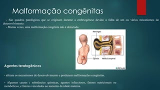 Agentes teratogênicos
Malformação congênitas
- afetam os mecanismos de desenvolvimento e produzem malformações congênitas.
- Algumas causas : substâncias químicas, agentes infecciosos, fatores nutricionais ou
metabólicos, e fatores vinculados ao aumento da idade materna.
- São quadros patológicos que se originam durante a embriogênese devido à falha de um ou vários mecanismos do
desenvolvimento.
- Muitas vezes, uma malformação congênita não é detectada.
 