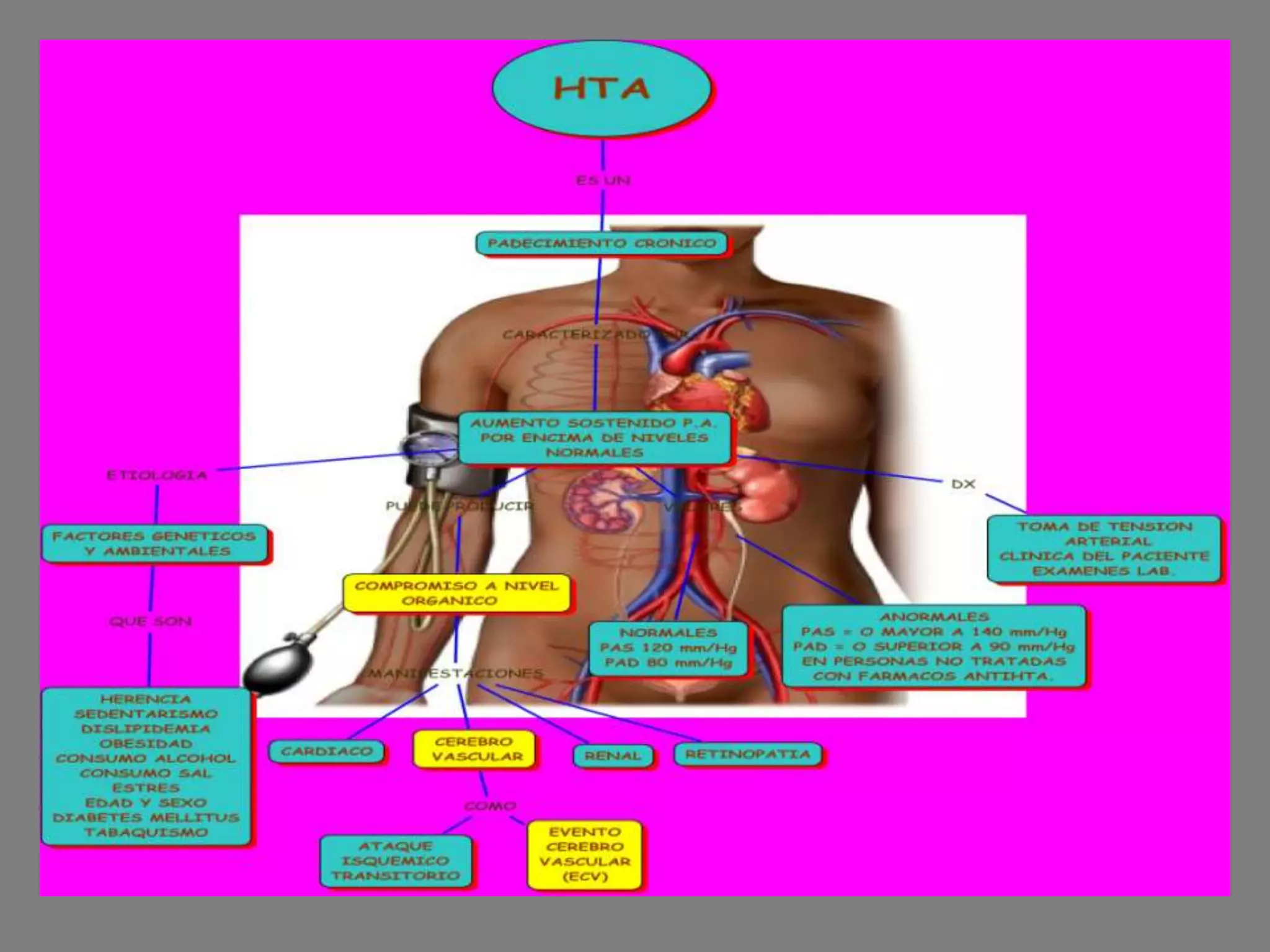 Mapa conceptual hipertension arterial (hta)