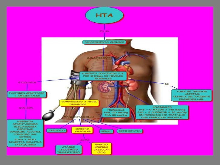 Mapa conceptual hipertension arterial (hta) Mapa conceptual hipertension arterial (hta)