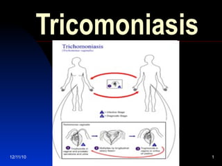 12/11/10 1
Tricomoniasis
 