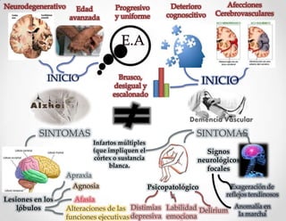 INICIO                                             INICIO



          SINTOMAS                                          SINTOMAS
                         Infartos múltiples
                         (que impliquen el                    Signos
                         córtex o sustancia                 neurológicos
                               blanca.
                                                              focales
                  Apraxia
                   Agnosia                    Psicopatológico         Exageración de
                                                     s              reflejos tendinosos
Lesiones en los     Afasia
    lóbulos       Alteraciones de las Distimias Labilidad Delirium Anomalía en
                                                                    la marcha
                  funciones ejecutivas depresiva emociona
 