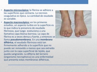 • Aspecto microscópico: la fibrina se adhiere a 
las superficies que contacta. La necrosis 
coagulativa es típica. La cantidad de exudado 
es variable. 
• Aspecto macroscópico: en los primeros 
estadíos, un aspecto turbio en la superficie es 
lo que indica la presencia de exudado 
fibrinoso, que luego evoluciona a una 
llamativa capa blanca borrosa. La capa de 
fibrina es a veces densa y fuerte, y entonces se 
llama pseudomembrana. En una membrana 
diftérica, el exudado fibrinoso está tan 
firmemente adherido a la superficie que no 
puede ser removido a menos que sea extraído 
junto con la capa superficial de tejido, que 
queda sangrando. La difteria del ternero 
(organismo necrophorus) es una enfermedad 
que presenta estas membranas diftéricas. 
 