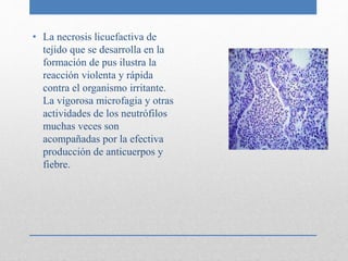 • La necrosis licuefactiva de 
tejido que se desarrolla en la 
formación de pus ilustra la 
reacción violenta y rápida 
contra el organismo irritante. 
La vigorosa microfagia y otras 
actividades de los neutrófilos 
muchas veces son 
acompañadas por la efectiva 
producción de anticuerpos y 
fiebre. 
 