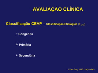 AVALIAÇÃO CLÍNICA
Classificação CEAP – Classificação Etiológica (EC,P,S)
 Congênita
 Primária
 Secundária
J Vasc Surg 1995;21(4):635-45
 