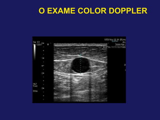 O EXAME COLOR DOPPLER
 