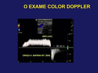 O EXAME COLOR DOPPLER
 