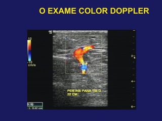 O EXAME COLOR DOPPLER
 