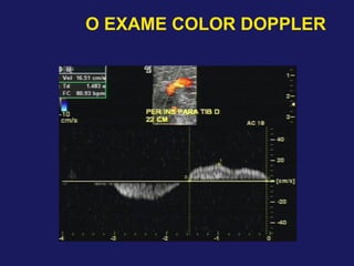 O EXAME COLOR DOPPLER
 