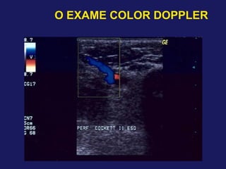 O EXAME COLOR DOPPLER
 