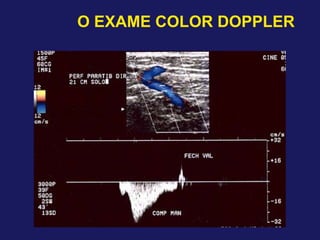 O EXAME COLOR DOPPLER
 