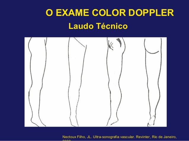 Exame doppler venoso
