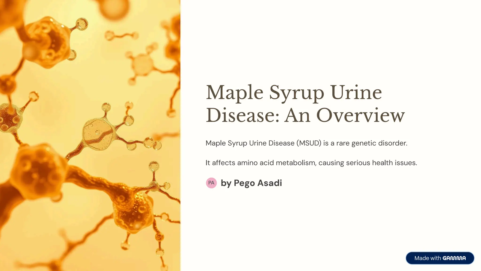 Msud Overview Maple-Syrup-Urine-Disease-An-Overview.pdf