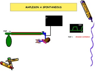 MAPLESON A SPONTANEOUS 