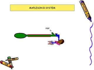 MAPLESON B SYSTEM 