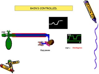 BAIN’S CONTROLLED. 