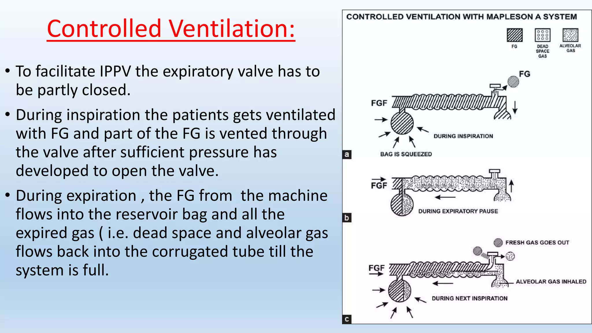 Mapleson breathing systems | PPTX