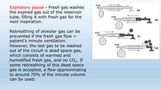 Expiratory pause - Fresh gas washes 
the expired gas out of the reservoir 
tube, filling it with fresh gas for the 
next inspiration. 
Rebreathing of alveolar gas can be 
prevented if the fresh gas flow = 
patient's minute ventilation. 
However, the last gas to be washed 
out of the circuit is dead space gas, 
which consists of warmed and 
humidified fresh gas, and no CO2. If 
some rebreathing of this dead space 
gas is accepted, a flow approximating 
to around 70% of the minute volume 
can be used: 
 
