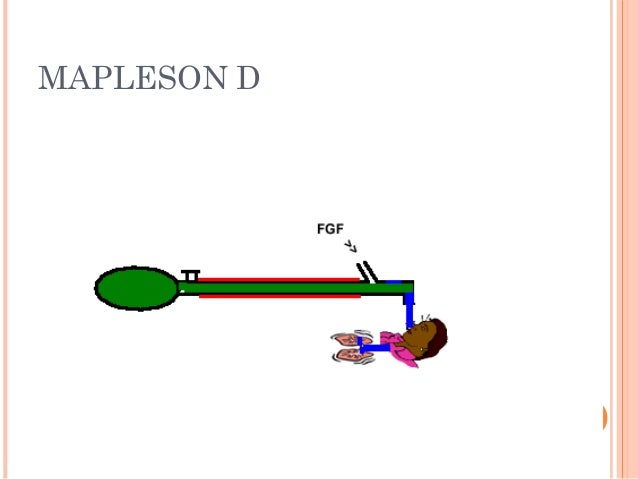 Mapleson circuits