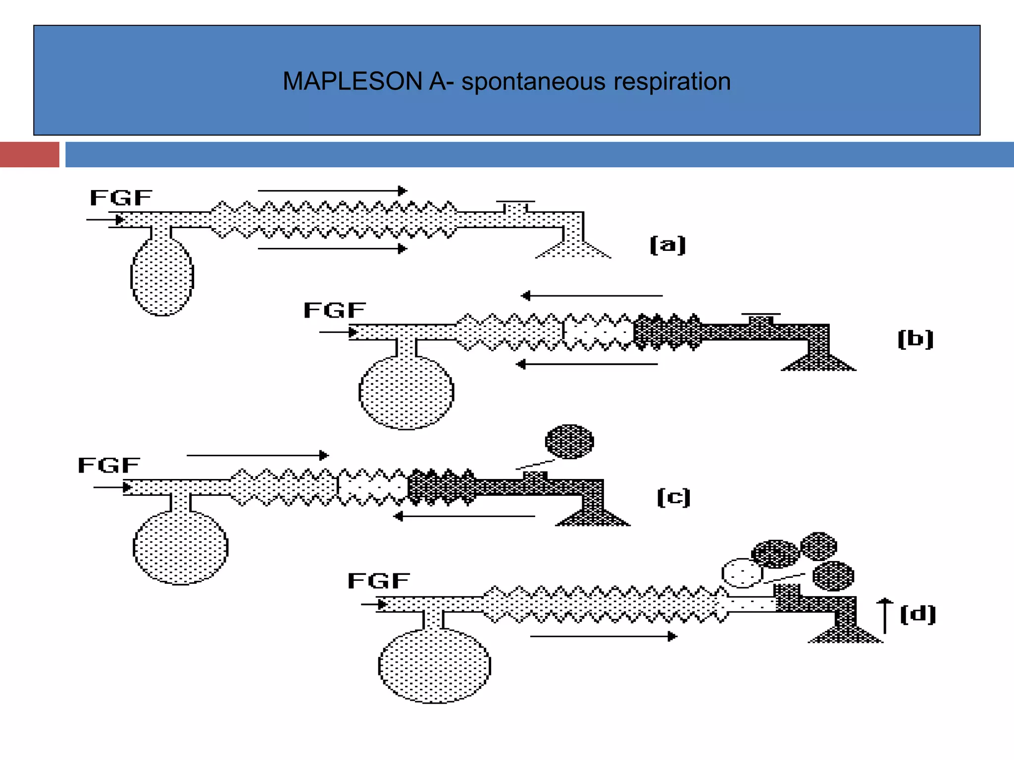 MAPLESON A- spontaneous respiration
 