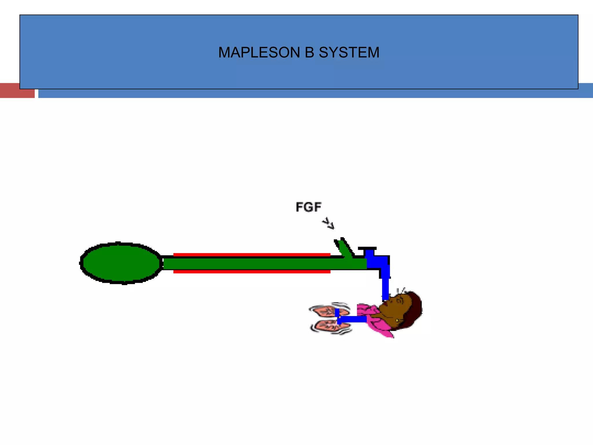 MAPLESON B SYSTEM
 