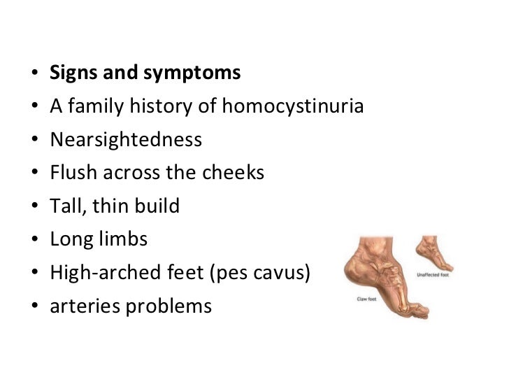 Maple syrup urine disease MSUD and Homocystinuria