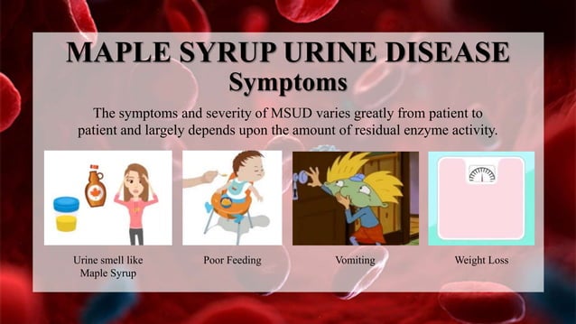 Maple Syrup Urine Disease | PPTX
