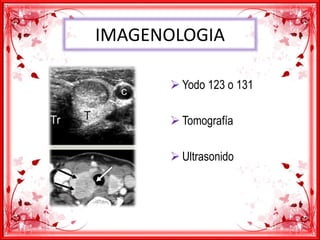 IMAGENOLOGIA
 Yodo 123 o 131
 Tomografía
 Ultrasonido
 