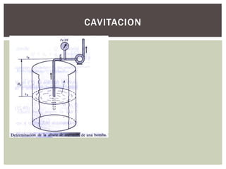 CAVITACION
 