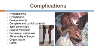 Complications
 Hypoglycemia
 Hypothermia
 Severe anemia
 Complete and partial paralysis
 Joint deformities
 Severe weakness
 Permanent vision loss
 Abnormality of tongue
 Organ failure
 Coma
 