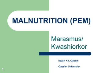MALNUTRITION (PEM)

            Marasmus/
            Kwashiorkor
              Najah Kh. Qasem

              Qassim University
1
 