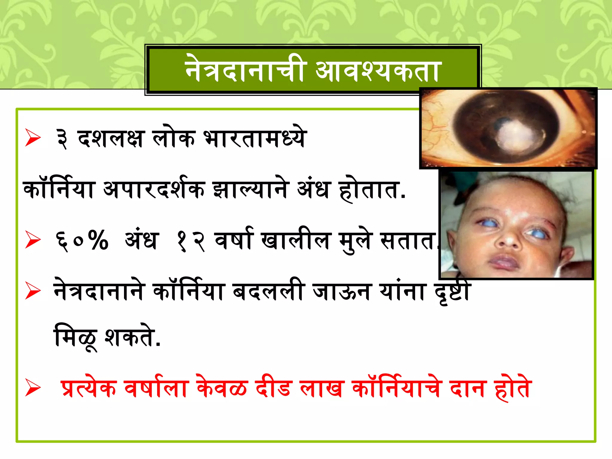  ३ दििक्ष िोक भारता्ध्ये
कॉर्षनया अपारदिशक झाल्याने अुंध होतात.
६०% अुंध १२ विाश खािीि ्मिे सतात.
नेत्रदानाने कॉर्षनया बदििी िाऊन याुंना दृिी
ल्ळू िकते.
प्रत्येक विाशिा के वळ दीड िाख कॉर्षनयाचे दान होते
नेत्रदानाची आवश्यकता